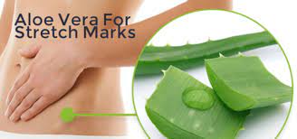 How to Remove Stretch Marks at Home